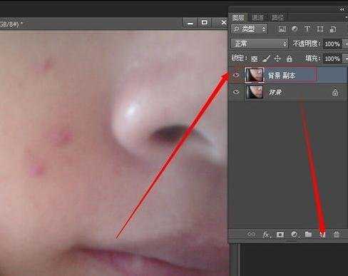 用photoshop去痘痘的方法