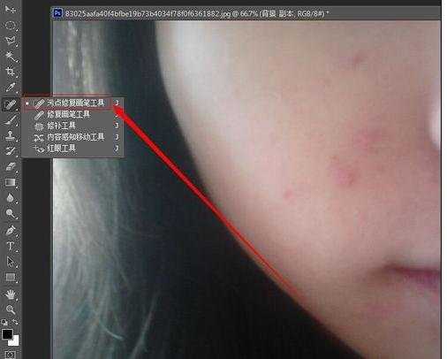 用photoshop去痘痘的方法