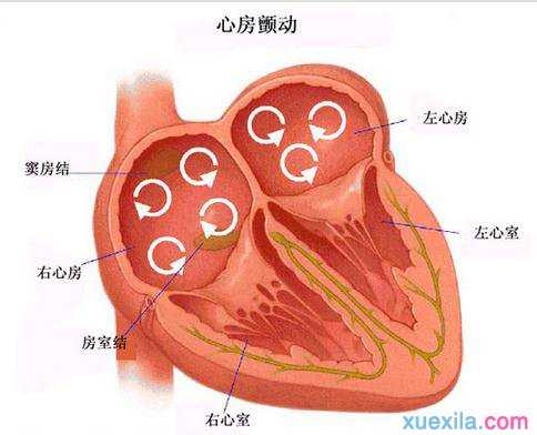 什么是房颤 房颤的治疗方法