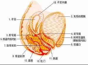 如何预防盆腔炎 盆腔炎的预防措施