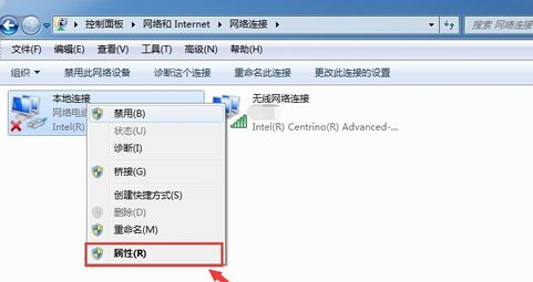 怎么设置局域网的本地ip