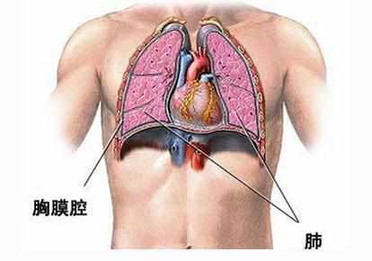 胸腔积液的原因有哪些_胸腔积液是什么原因引起