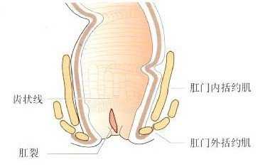 大便痛是什么原因造成